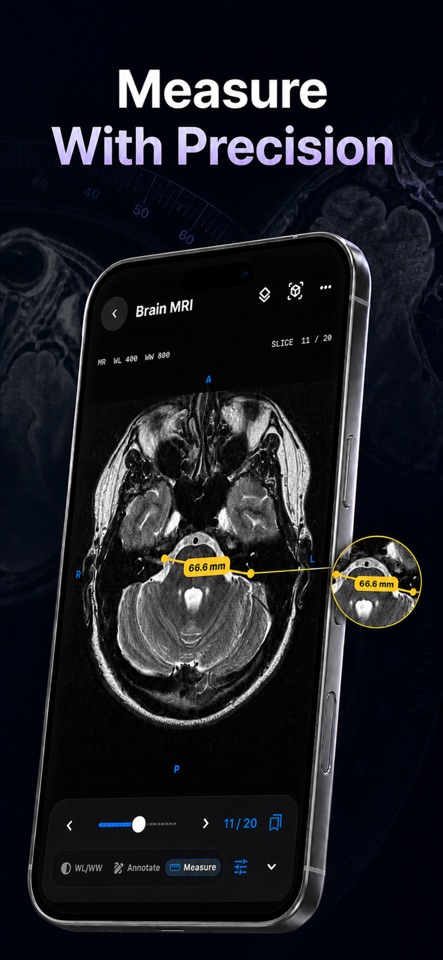 Reference measurement tools in DICOM Studio