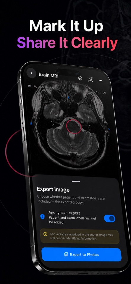 Markup and sharing tools in DICOM Studio